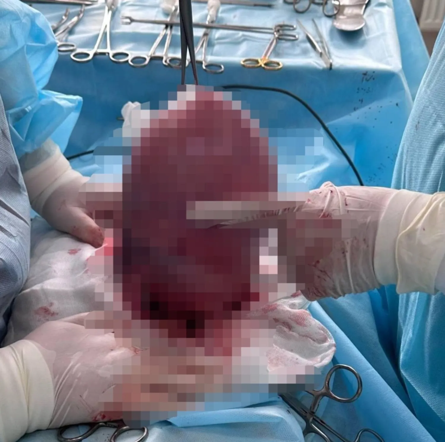 МЗ РБ телеграм