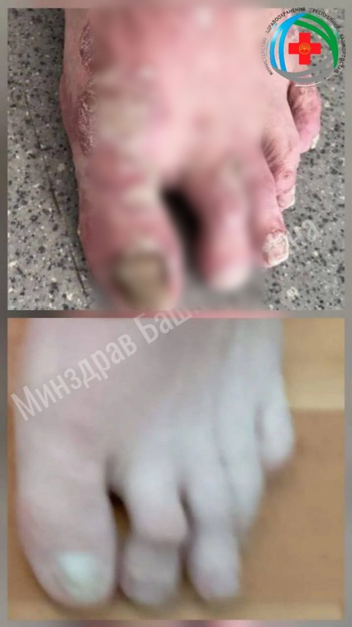 минздрав РБ ТГ-канал