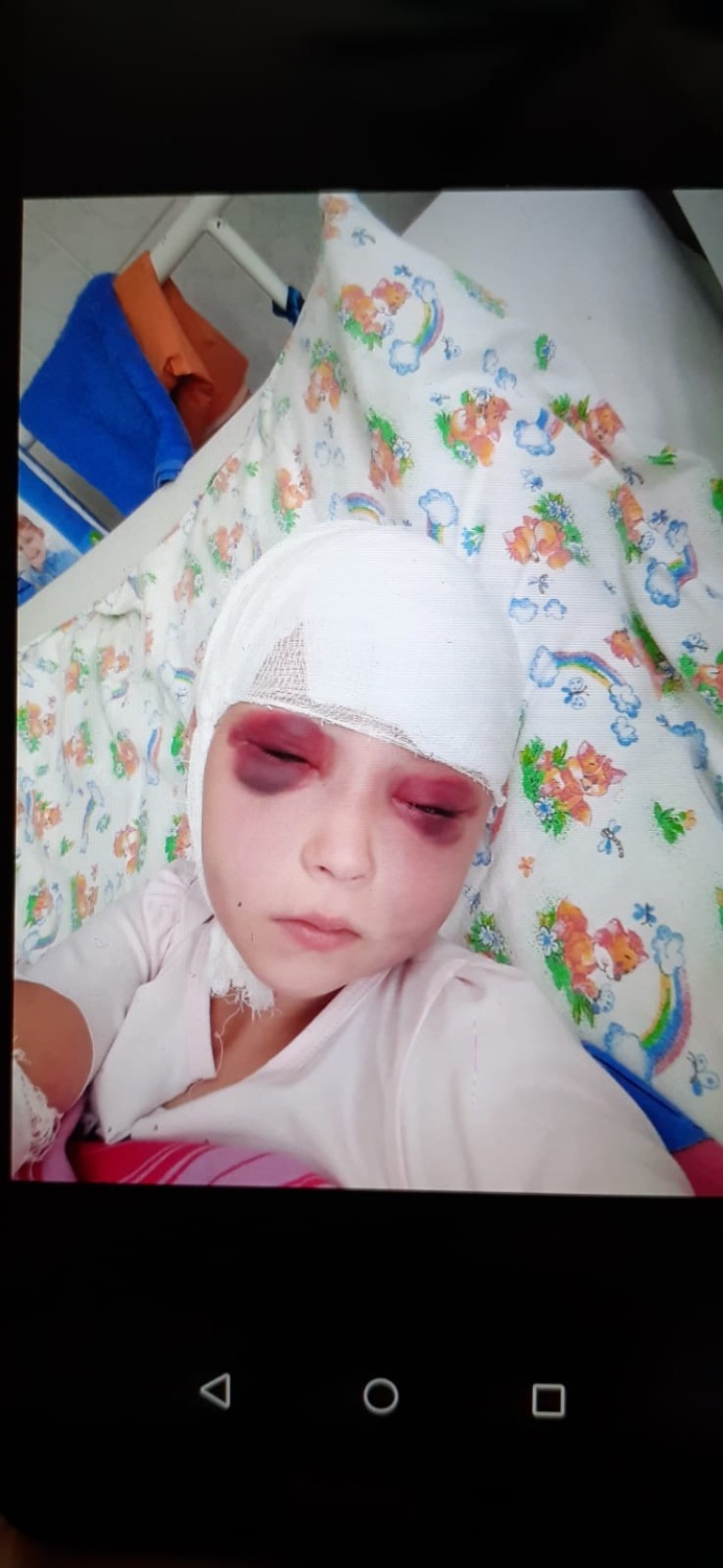 Личный архив Алены Леонтьевой Полина через несколько дней после первой операции