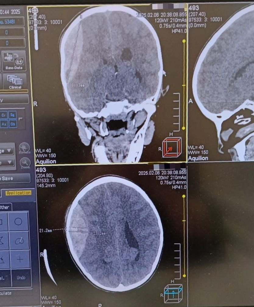 Ильшат Яппаров, Vk