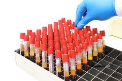 Сегодня - Всемирный день памяти умерших от СПИДа