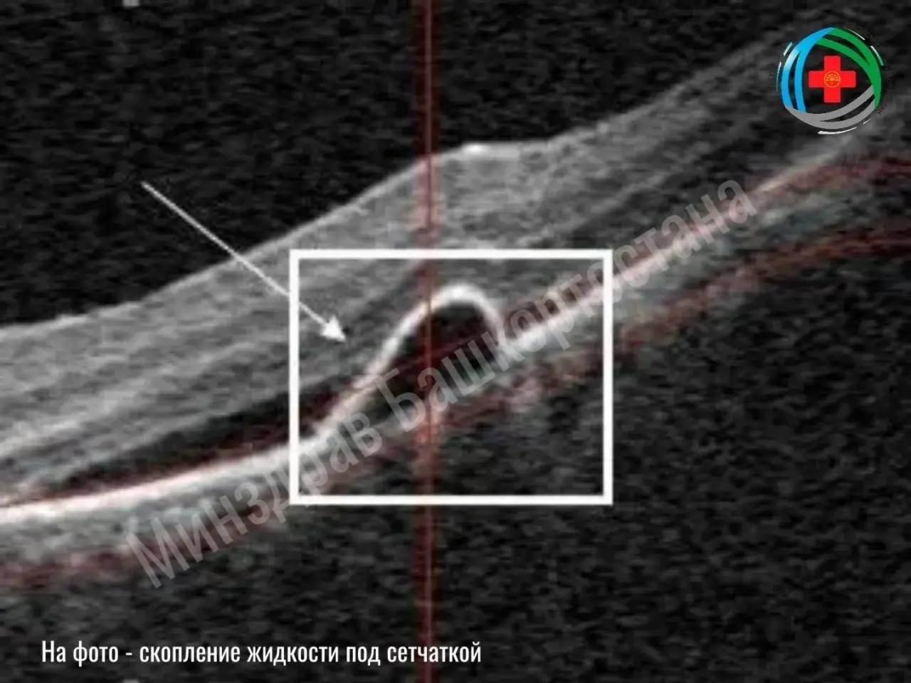Айрат Рахматуллин ВК