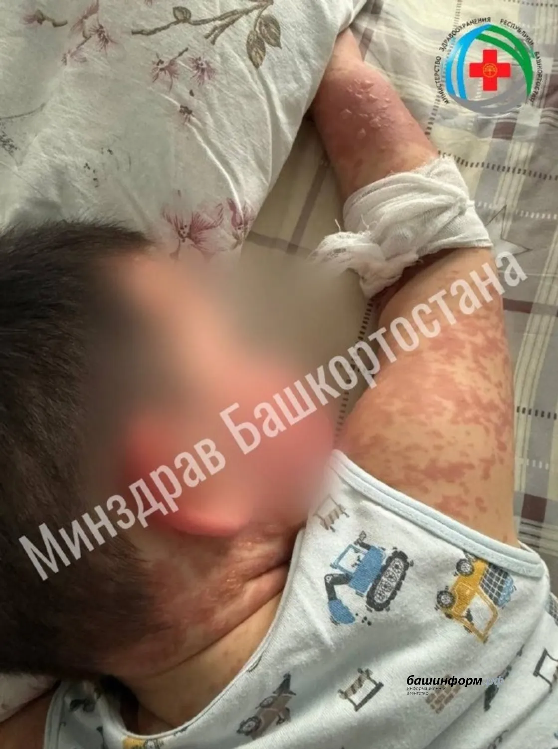 МЗ РБ телеграм