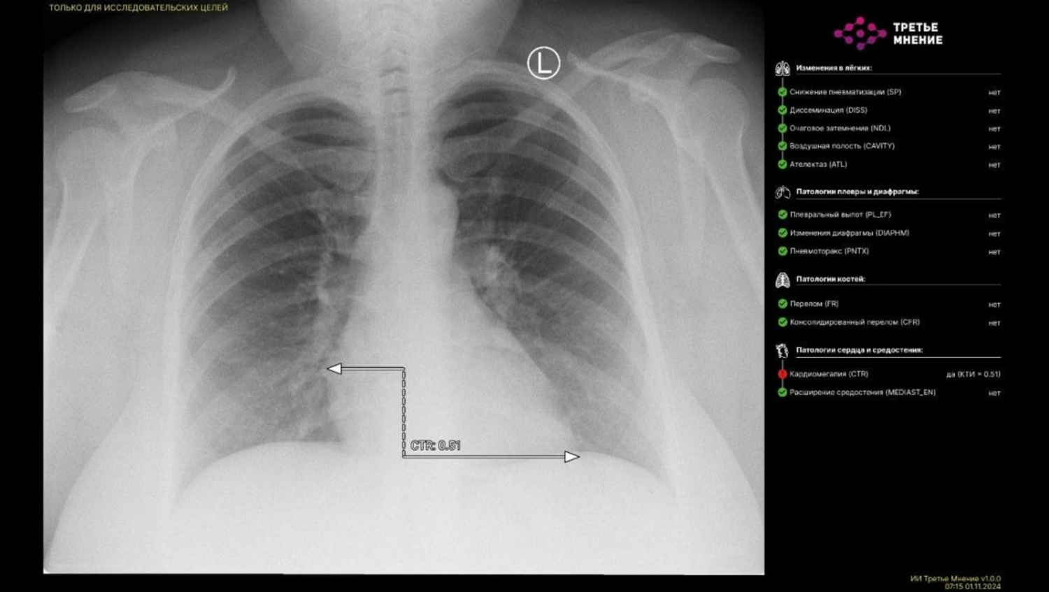 ТГ-канал Айрата Рахматуллина